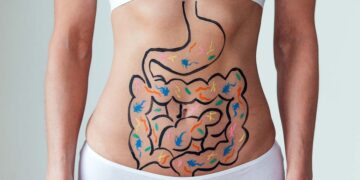 İrritabl Bağırsak Sendromu (IBS)