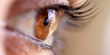 Yaşa Bağlı Maküler Dejenerasyon (AMD) ve Beslenmenin Rolü