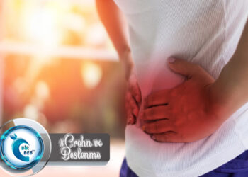 Crohn Hastalığı ve Beslenme