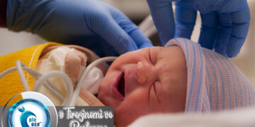 Kalıtsal Tirozinemi ve Beslenme Tedavisi