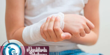 Yanık Durumlarında Beslenme Tedavisi Nasıl Olmalıdır?