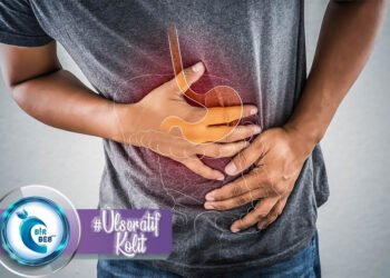 Ülseratif Kolit Nedir? Diyet Tedavisi Nasıl Olmalıdır?