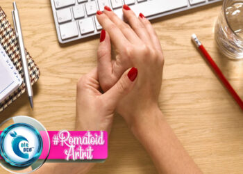 Romatoid Artrit Nedir? Beslenme Tedavisi Nasıldır?