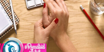 Romatoid Artrit Nedir? Beslenme Tedavisi Nasıldır?