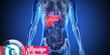 Karaciğer Yağlanması Nedir? Beslenme Tedavisi Nasıldır?