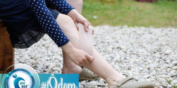 “Kilo Değil, Ödem Var Bende” Diyenleri Mutlu Edecek Basit Yollar