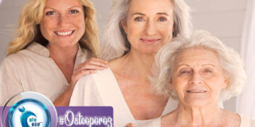 Osteoporoz (Kemik Erimesi) Nedir? Nasıl Önlenir? Kimler Risk Altındadır?