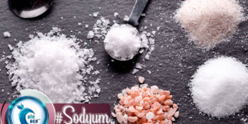 Sodyum (Na) Nedir? Hangi Besinlerde Bulunur? Sağlık Üzerine Etkileri Nelerdir?
