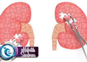 Nefrotik Sendrom Nedir? Tıbbi Beslenme Tedavisi Nasıl Olmalıdır?