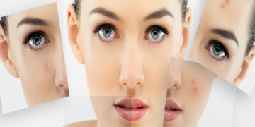 Cilt Sağlığı ve Beslenme İlişkisi