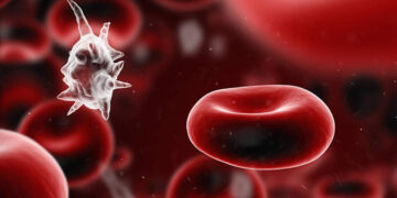 Sepsis Nedir? Etkileri Nelerdir? Beslenme Tedavisi Nasıldır?