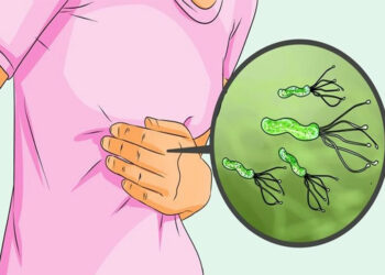 Gastrit Nedir? Belirtileri Nelerdir? Vitamin C’nin Gastrit Üzerine Etkileri Nelerdir?