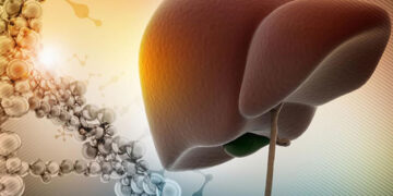 Karaciğer Kanseri Nedir? Neden Olur? Kanser Hastaları Nasıl Beslenmelidir?