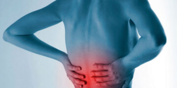 Ankilozan Spondilit Nedir? Beslenme Tedavisi Nasıl Olmalıdır?