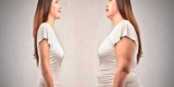 Obezite Nedir? Nedenleri Nelerdir? Tedavisi Nasıldır?