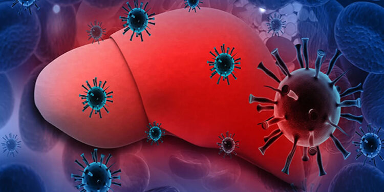 Hepatit B (Sarılık) Nedir? Nasıl Bulaşır? Semptomları Nelerdir? Tedavisi Nasıldır?