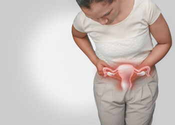 Polikistik Over Sendromu Nedir? Obezite İle Bağlantısı Nasıldır?