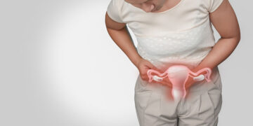 Polikistik Over Sendromu Nedir? Obezite İle Bağlantısı Nasıldır?