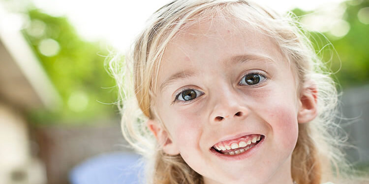 Prader Willi Sendromu (PWS) Nedir? Belirtileri Nelerdir? Nasıl Tedavi Edilir?