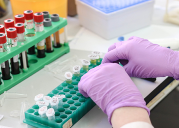 Hiperlipoproteinemi Nedir? Çeşitleri Nelerdir? Beslenme Tedavisi Nasıl Olmalıdır?
