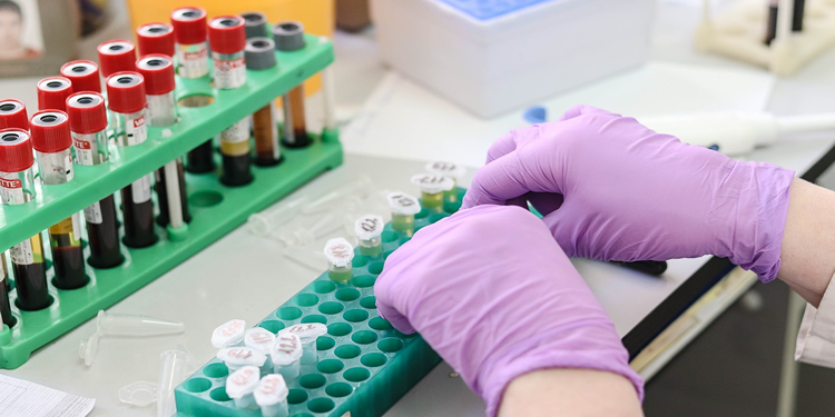 Hiperlipoproteinemi Nedir? Çeşitleri Nelerdir? Beslenme Tedavisi Nasıl Olmalıdır?