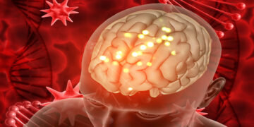 Wernicke Korsakoff Sendromu Nedir? Belirtileri ve Etkileri Nelerdir? Dikkat Edilmesi Gerekenler Nelerdir?