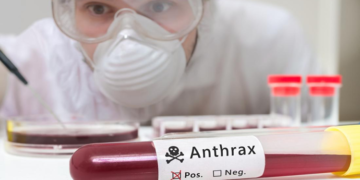 Şarbon Hastalığı Nedir? Biyolojik Savaş Mı? Salgın Mı?