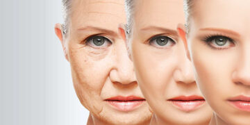 Anti Aging (Yaşlanma Karşıtı) Beslenme Nedir? Diyet Nasıl Olmalıdır?