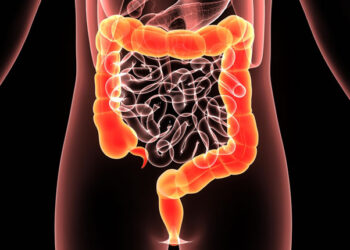 Kolostomi Nedir? Kolostomili Hastanın Beslenme Tedavisi Nasıl Olmalıdır?
