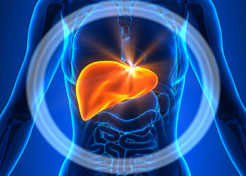 Alkolik Karaciğer Hastalığı Nedir? Beslenme Tedavisi Nasıl Olmalıdır?